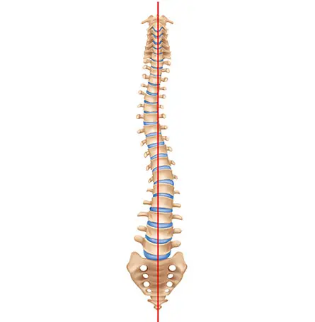 Un'immagine della colonna vertebrale con scoliosi